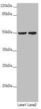 Solute Carrier Family 39 Member 7 antibody, LS-C676513, Lifespan Biosciences, Western Blot image 