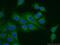 Death Inducer-Obliterator 1 antibody, 11790-1-AP, Proteintech Group, Immunofluorescence image 