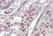 Non-Homologous End Joining Factor 1 antibody, NB100-53799, Novus Biologicals, Immunohistochemistry paraffin image 