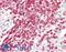 Coronin 1A antibody, LS-B10416, Lifespan Biosciences, Immunohistochemistry paraffin image 