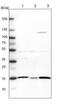 ATP Synthase F1 Subunit Delta antibody, PA5-51758, Invitrogen Antibodies, Western Blot image 