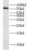 Dishevelled Segment Polarity Protein 3 antibody, FNab02574, FineTest, Western Blot image 