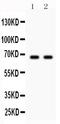 Parkin RBR E3 Ubiquitin Protein Ligase antibody, PB9307, Boster Biological Technology, Western Blot image 