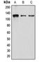 Atrophin 1 antibody, LS-C352119, Lifespan Biosciences, Western Blot image 