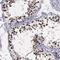 VRK Serine/Threonine Kinase 1 antibody, NBP1-85822, Novus Biologicals, Immunohistochemistry frozen image 