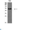 Endothelin Receptor Type B antibody, LS-C813306, Lifespan Biosciences, Immunohistochemistry paraffin image 