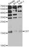 Cystatin SN antibody, LS-C748347, Lifespan Biosciences, Western Blot image 