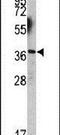 Engrailed Homeobox 2 antibody, PA5-14364, Invitrogen Antibodies, Western Blot image 