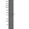 SWI/SNF Related, Matrix Associated, Actin Dependent Regulator Of Chromatin, Subfamily B, Member 1 antibody, abx218670, Abbexa, Western Blot image 