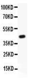ATP Binding Cassette Subfamily C Member 4 antibody, PA5-78695, Invitrogen Antibodies, Western Blot image 