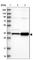 G-Patch Domain Containing 11 antibody, HPA038231, Atlas Antibodies, Western Blot image 