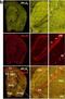 Phospholipase A2 Group VI antibody, NBP1-81586, Novus Biologicals, Immunohistochemistry paraffin image 