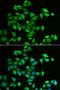 Uncharacterized glycosyltransferase AGO61 antibody, LS-C335679, Lifespan Biosciences, Immunofluorescence image 