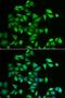 Protein O-Linked Mannose N-Acetylglucosaminyltransferase 2 (Beta 1,4-) antibody, LS-C335679, Lifespan Biosciences, Immunofluorescence image 