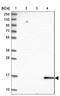 Cysteine And Glycine Rich Protein 3 antibody, NBP2-13880, Novus Biologicals, Western Blot image 