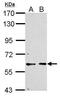 Cyclin Dependent Kinase 16 antibody, GTX112013, GeneTex, Western Blot image 