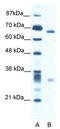 ASH2 Like, Histone Lysine Methyltransferase Complex Subunit antibody, TA335740, Origene, Western Blot image 