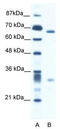 SET1 antibody, TA335740, Origene, Western Blot image 