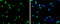 Selenoprotein K antibody, GTX131124, GeneTex, Immunocytochemistry image 