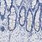 Aquaporin 1 (Colton Blood Group) antibody, NBP1-84488, Novus Biologicals, Immunohistochemistry paraffin image 