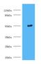 Trimethyllysine Hydroxylase, Epsilon antibody, LS-C318976, Lifespan Biosciences, Western Blot image 