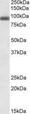 PR/SET Domain 1 antibody, EB09715, Everest Biotech, Western Blot image 