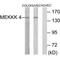 Mitogen-Activated Protein Kinase Kinase Kinase Kinase 4 antibody, PA5-49780, Invitrogen Antibodies, Western Blot image 