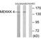 Mitogen-Activated Protein Kinase Kinase Kinase Kinase 4 antibody, PA5-49780, Invitrogen Antibodies, Western Blot image 