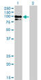 OCRL Inositol Polyphosphate-5-Phosphatase antibody, LS-B6106, Lifespan Biosciences, Western Blot image 