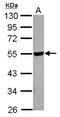 Hyaluronidase 2 antibody, NBP2-21609, Novus Biologicals, Western Blot image 