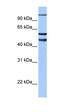 Enhancer Of Zeste 1 Polycomb Repressive Complex 2 Subunit antibody, orb329768, Biorbyt, Western Blot image 