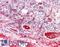 Complement C3 antibody, LS-C44976, Lifespan Biosciences, Immunohistochemistry paraffin image 