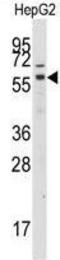 G Protein-Coupled Receptor Kinase 7 antibody, GTX53604, GeneTex, Western Blot image 