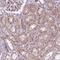 Rho Family GTPase 3 antibody, HPA060504, Atlas Antibodies, Immunohistochemistry paraffin image 
