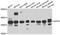 Regulation Of Nuclear Pre-MRNA Domain Containing 1B antibody, A10102, ABclonal Technology, Western Blot image 
