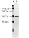 Angiotensin II Receptor Type 2 antibody, A00432, Boster Biological Technology, Western Blot image 