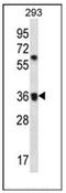 Olfactory Receptor Family 52 Subfamily E Member 2 antibody, AP53077PU-N, Origene, Western Blot image 