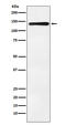 BUB1 Mitotic Checkpoint Serine/Threonine Kinase antibody, M00776-1, Boster Biological Technology, Western Blot image 