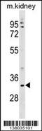 Transmembrane Protein 178A antibody, 59-531, ProSci, Western Blot image 