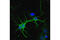 Calcium/Calmodulin Dependent Protein Kinase II Alpha antibody, 50049S, Cell Signaling Technology, Immunocytochemistry image 