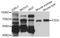 Frizzled Class Receptor 4 antibody, STJ110460, St John