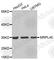 Mitochondrial Ribosomal Protein L45 antibody, A5052, ABclonal Technology, Western Blot image 