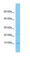 BolA Family Member 3 antibody, orb326706, Biorbyt, Western Blot image 