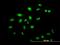 Zinc Finger Protein 136 antibody, H00007695-M03, Novus Biologicals, Immunocytochemistry image 