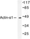 Actin Alpha 1, Skeletal Muscle antibody, LS-C175909, Lifespan Biosciences, Western Blot image 