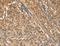 Aminoacyl TRNA Synthetase Complex Interacting Multifunctional Protein 1 antibody, LS-C403125, Lifespan Biosciences, Immunohistochemistry paraffin image 