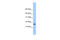 Centromere Protein W antibody, 26-867, ProSci, Western Blot image 