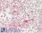 Nuclear Receptor Subfamily 3 Group C Member 1 antibody, LS-B14669, Lifespan Biosciences, Immunohistochemistry paraffin image 