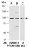 Prominin 1 antibody, R2946-1, Abiocode, Western Blot image 