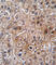 Bone Morphogenetic Protein Receptor Type 2 antibody, abx031368, Abbexa, Western Blot image 